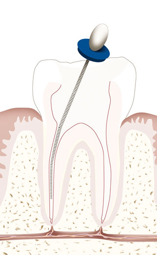 behandlungen_endodontie_small2_big.jpg